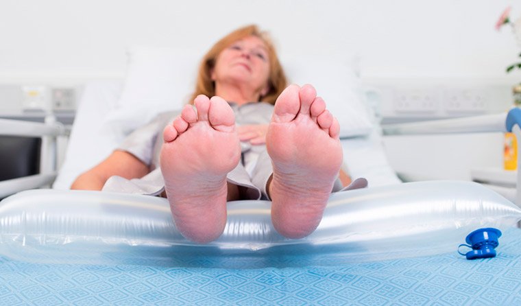 Alivio de talón Repose Mujer usando cojín Repose para elevar y proteger los talones en cama