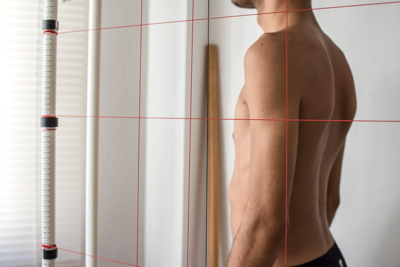 Dismetría de piernas o de caderas: qué es, síntomas y soluciones Evaluación de postura para detectar dismetría de piernas o caderas