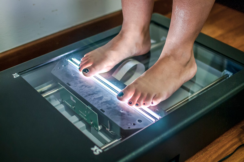 Dismetría de piernas o de caderas: qué es, síntomas y soluciones Mujer realizando análisis plantar en escáner para detectar dismetría de piernas