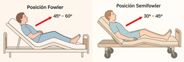 Posici n Fowler Y Semifowler Qu Son Beneficios Y Cuidados